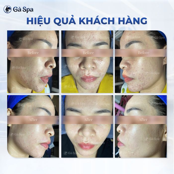 Gà Spa hình ảnh 1