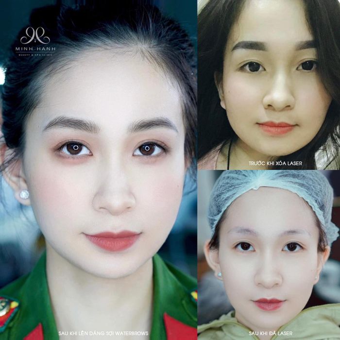 Minh Hanh Beauty hình ảnh 2