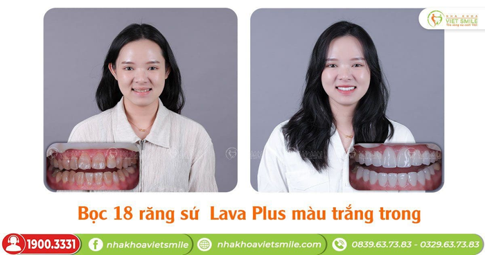 Ảnh 1 của Nha khoa Việt Smile