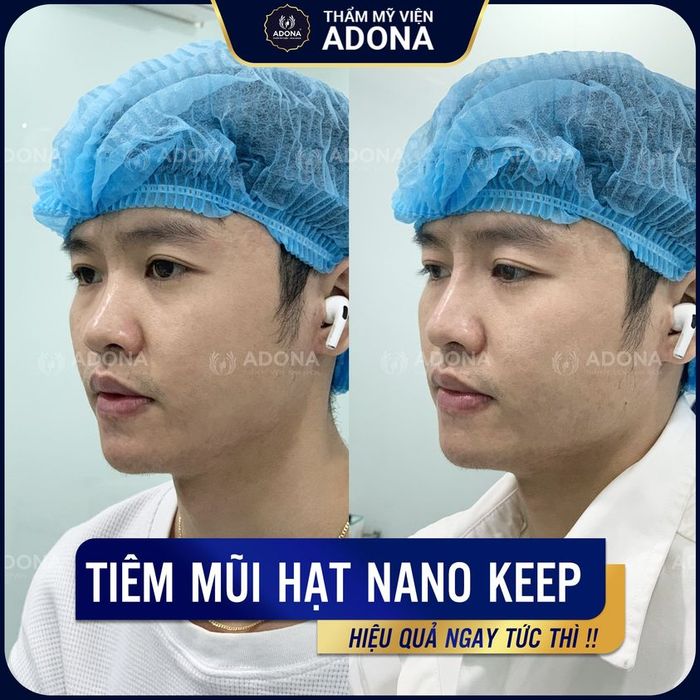 Hình ảnh Thẩm Mỹ Viện ADONA 2