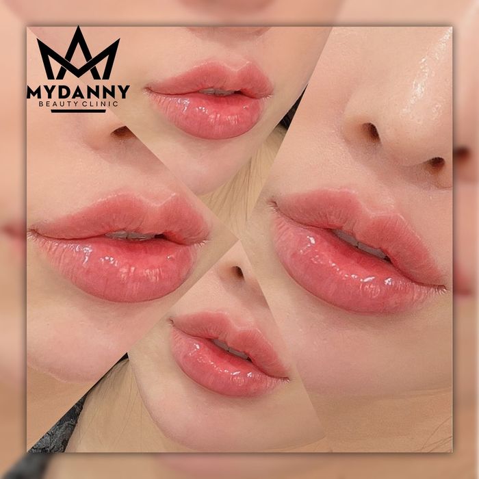 Hình ảnh Mydanny Beauty Clinic 1