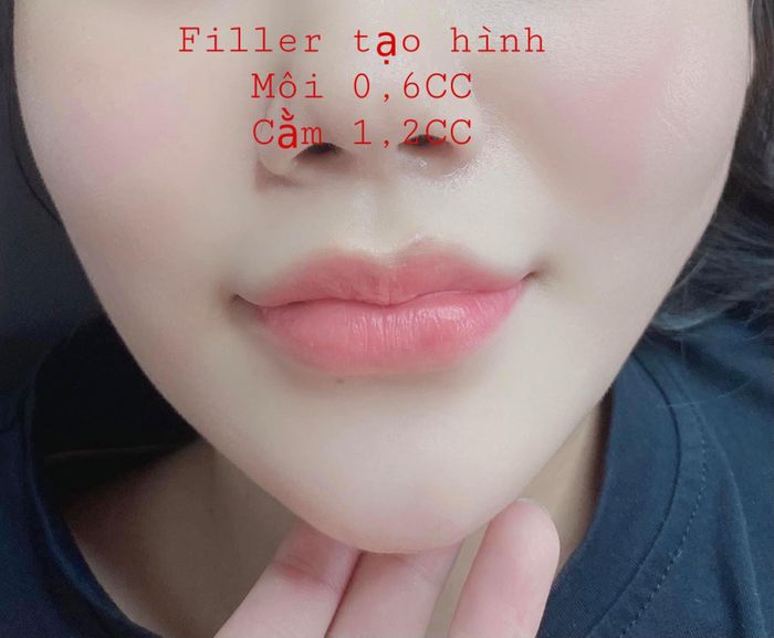 Ly Beauty & Clinic - Hình ảnh 2