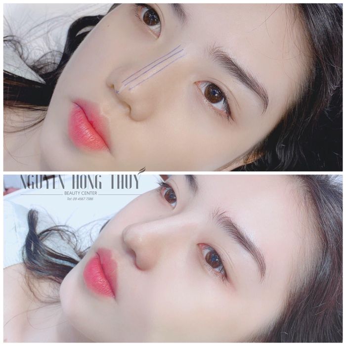 Ảnh 1 của Trung Tâm Làm Đẹp Nguyễn Hồng Thúy