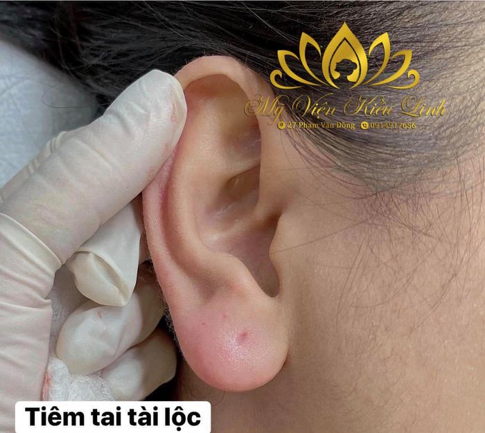Ảnh 2 tại Mỹ Viện Kiều Linh
