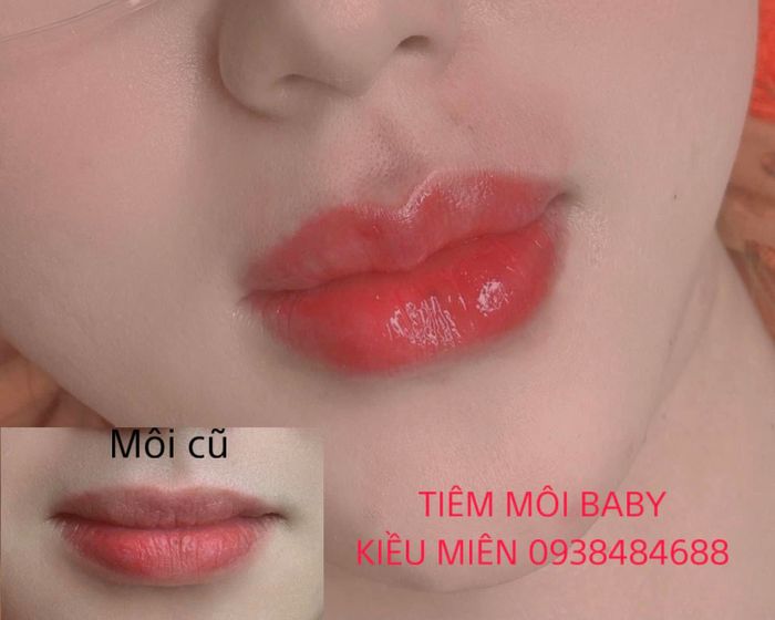 Viện Thẩm Mỹ Lady Kiều Miên - Hình ảnh 1