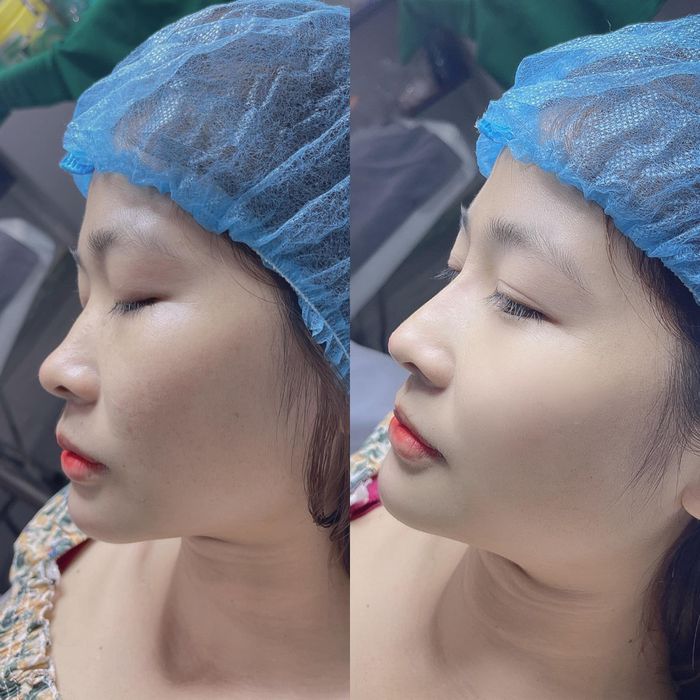 Ly Beauty & Clinic - Hình ảnh 1