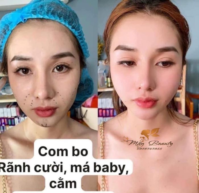 Hình ảnh 2 của Mây Beauty