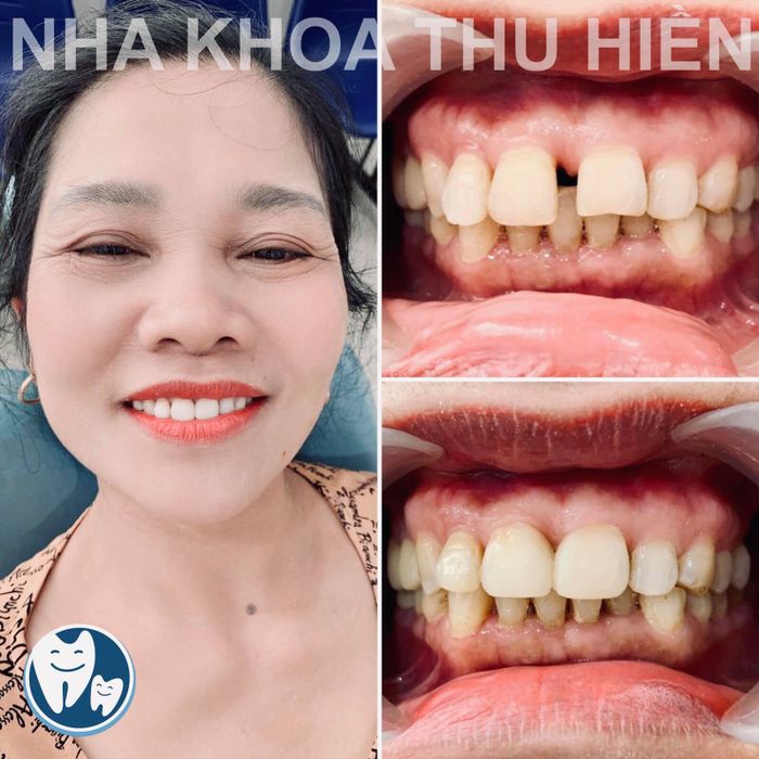 Hình ảnh Nha Khoa Thu Hiền 1