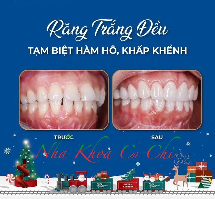 NHA KHOA CỦ CHI Hình 1