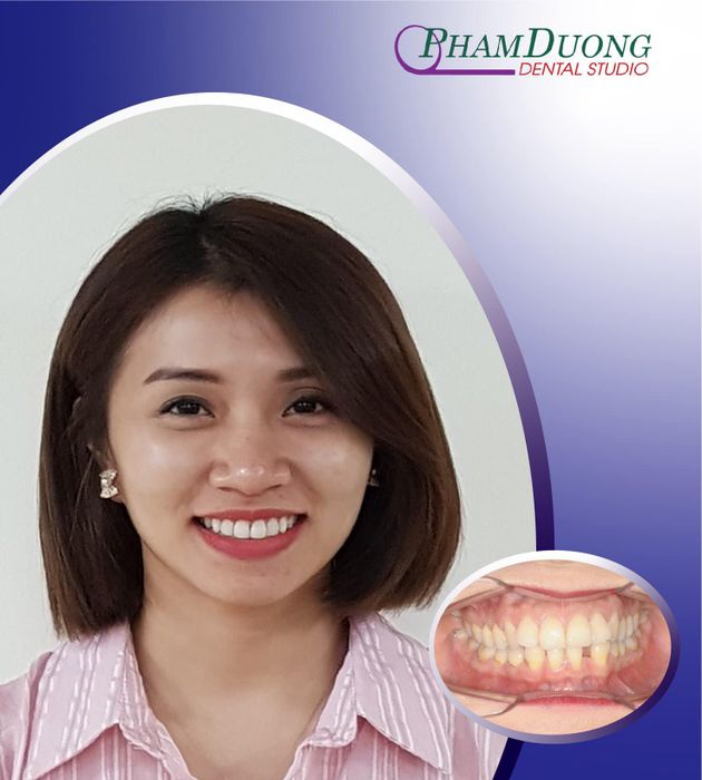 PHÒNG KHÁM RĂNG HÀM MẶT PHẠM DƯƠNG - Hình 1