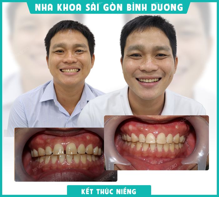 Hình ảnh 1 của Nha khoa Sài Gòn Bình Dương