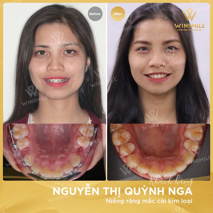 Nha Khoa Thẩm Mỹ Quốc Tế Win Smile - Hình ảnh 2