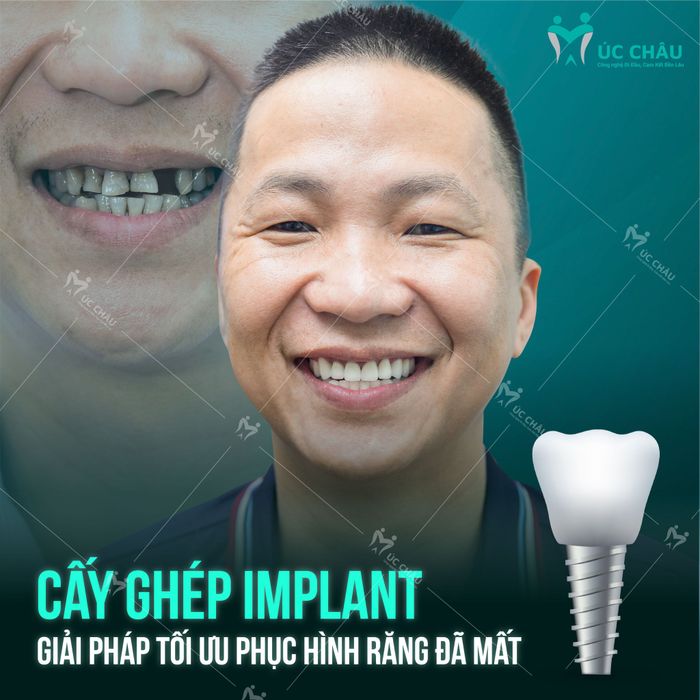 Hình ảnh Nha Khoa Úc Châu Quảng Ninh