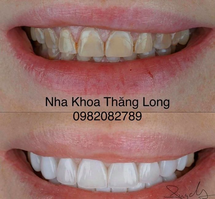 Ảnh 2 của Nha khoa Thăng Long Hà Nam