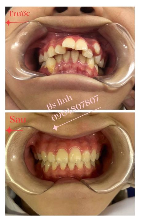 Hình ảnh Nha Khoa Quốc Tế An Bình 1