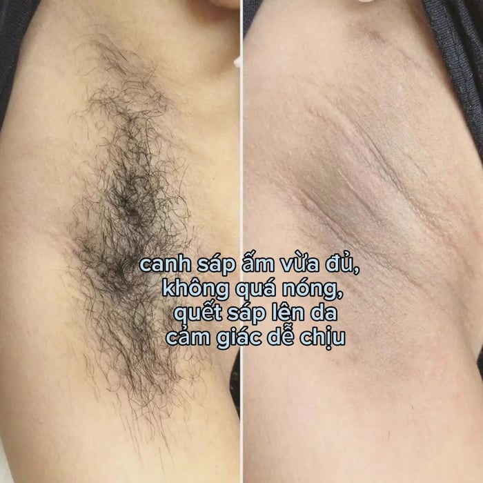 Gentle Waxing hình ảnh 1