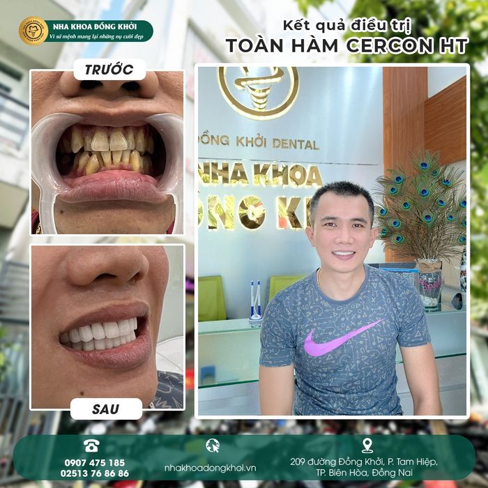 Ảnh 2 của Nha Khoa Đồng Khởi
