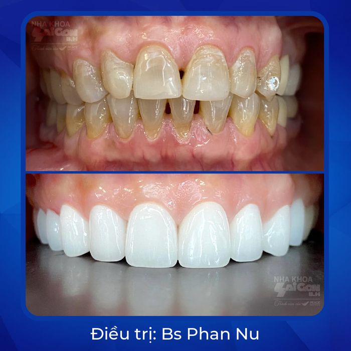 Nha Khoa Sài Gòn B.H - Hố Nai hình 1