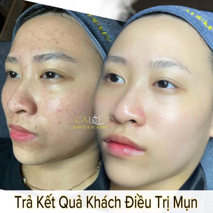 Hình ảnh 1 của Calee Spa - Trung Tâm Thẩm Mỹ TP. Vĩnh Long