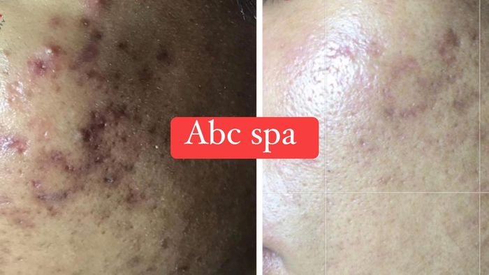 Hình ảnh 2 của ABC Spa & Clinic Vĩnh Long