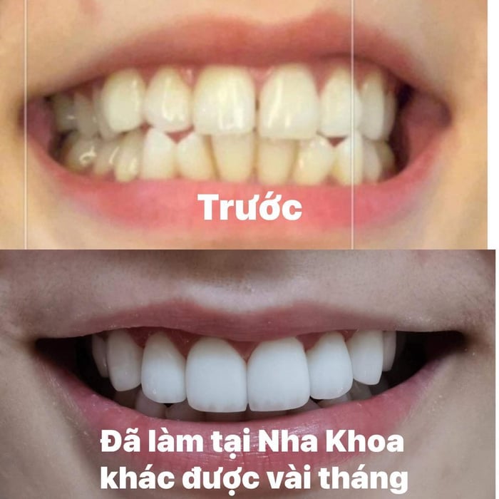 Ảnh 2 của Nha Khoa Kim Smile