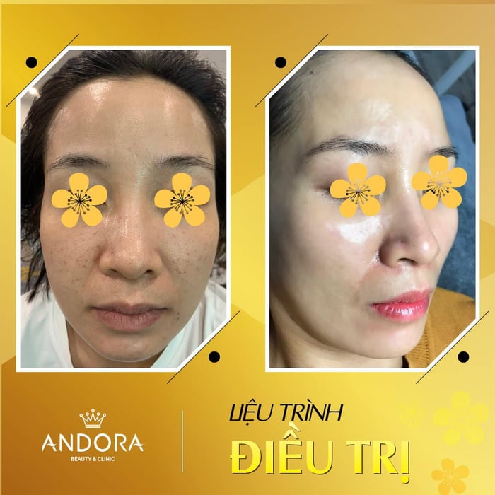 Hình ảnh 1 của Andora Beauty & Clinic