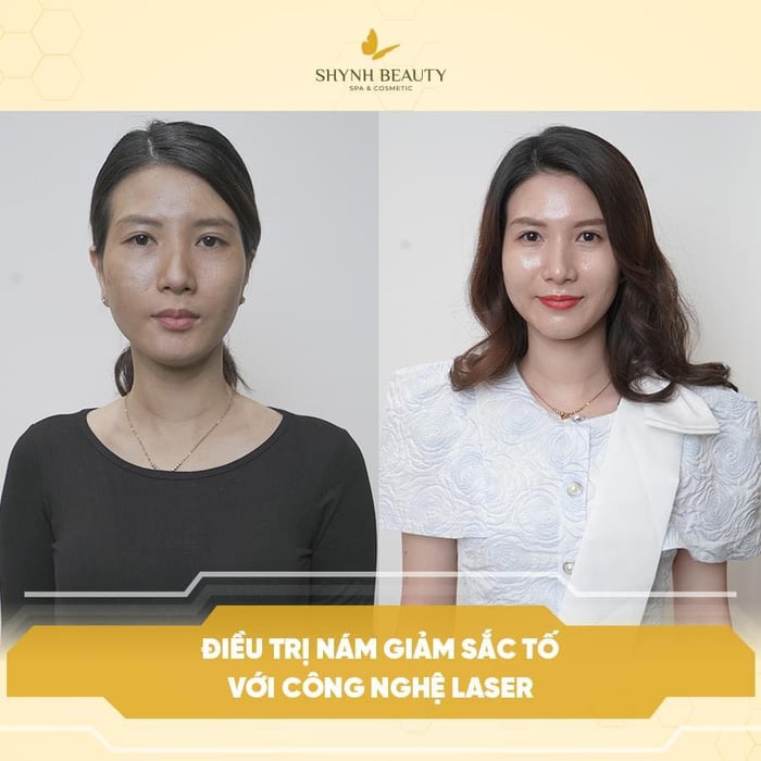 Ảnh 1 của Shynh Beauty Spa