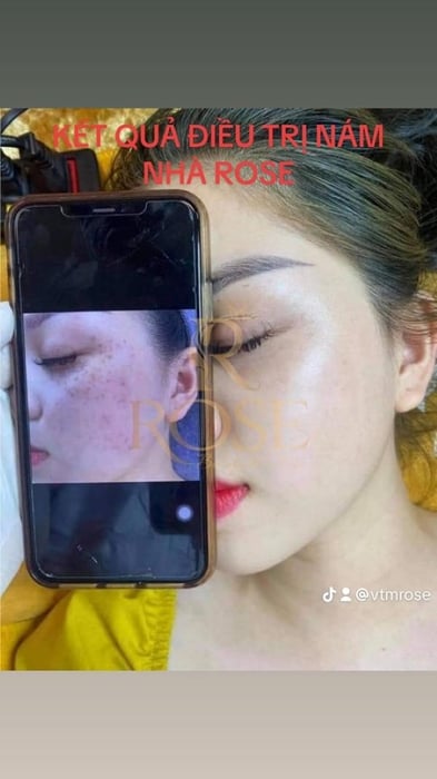 Hình ảnh 1 của Rose Beauty Spa