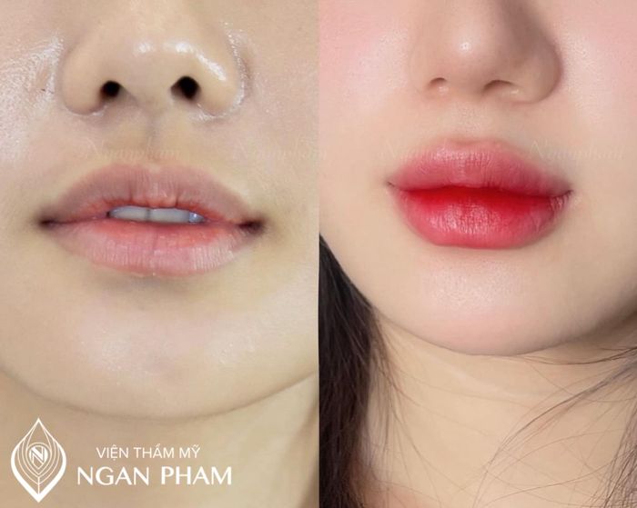 Hình ảnh 2 của Viện Thẩm Mỹ Ngan Pham