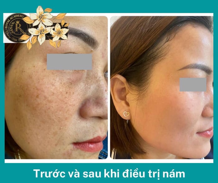 Hình ảnh Spa Beauty Royal 1