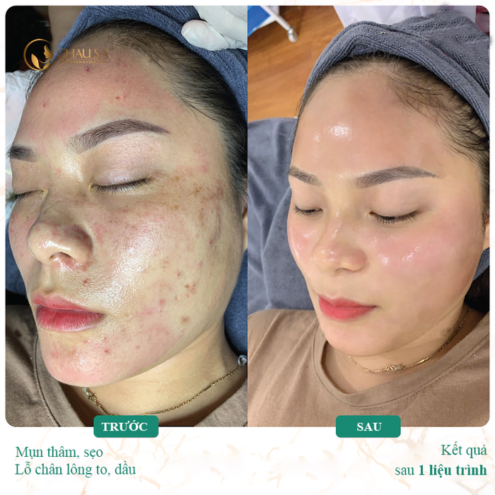 Hình ảnh của Châu Sa International Clinic & Spa số 2