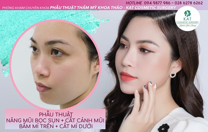 Hình ảnh 2 của KAT Cosmetic Surgery