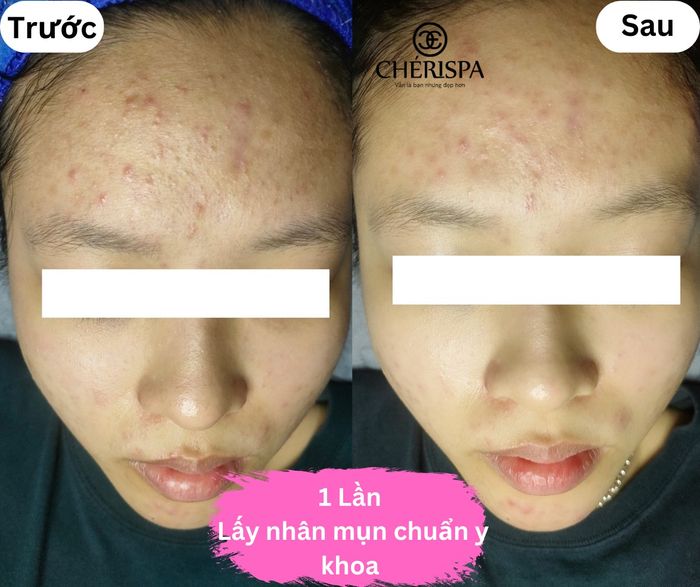 Hình ảnh Chérispa Quảng Ngãi số 1