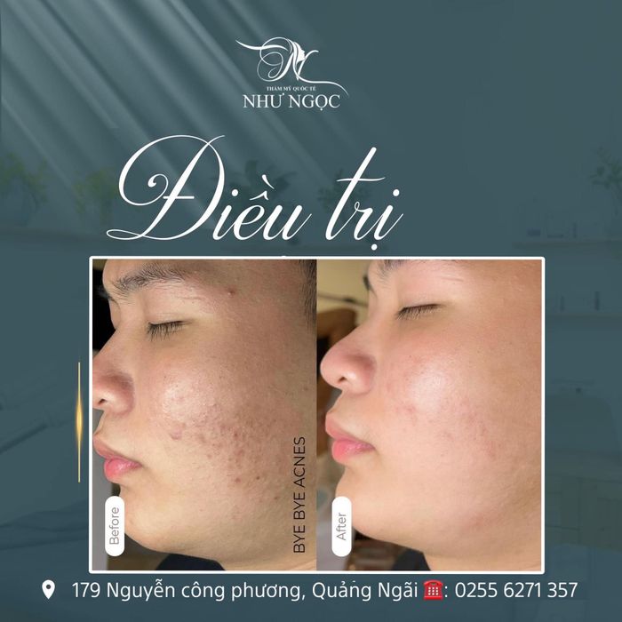 Ngọc Beauty Spa & Clinic hình ảnh 2