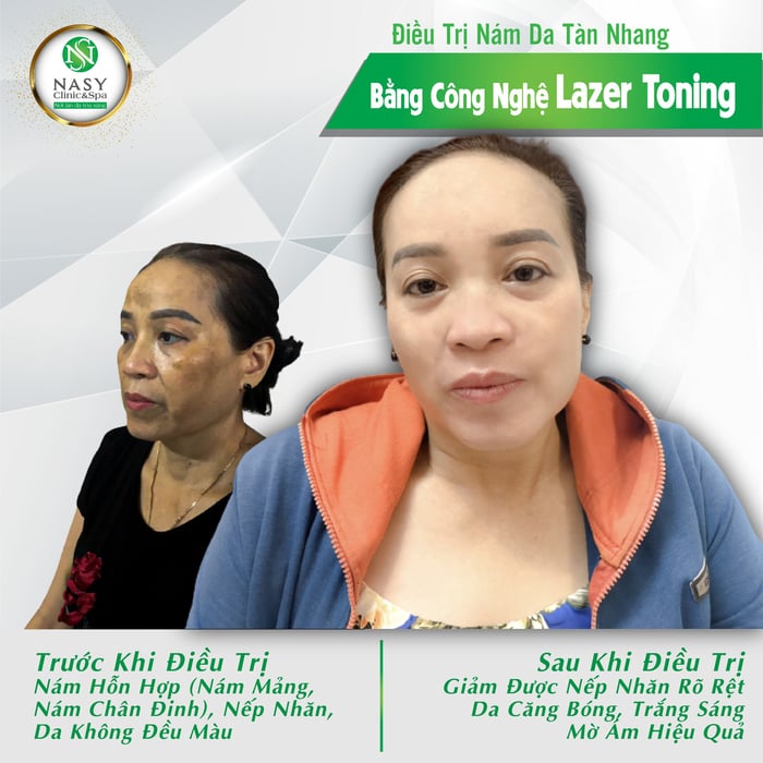 Ảnh 1 của Nasy Spa