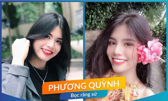 Hình ảnh tại Nha khoa Doremi - Ảnh 1