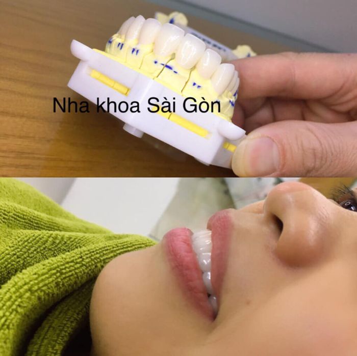 Nha khoa Sài Gòn - Ảnh 2
