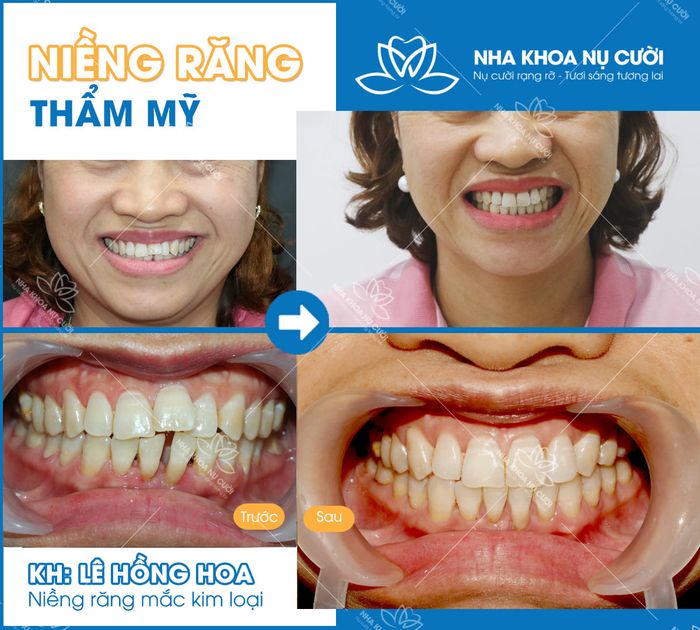 Hình ảnh Nha Khoa Nụ Cười 1