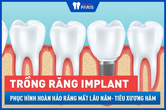 Hình ảnh Nha khoa Paris Đà Nẵng 2