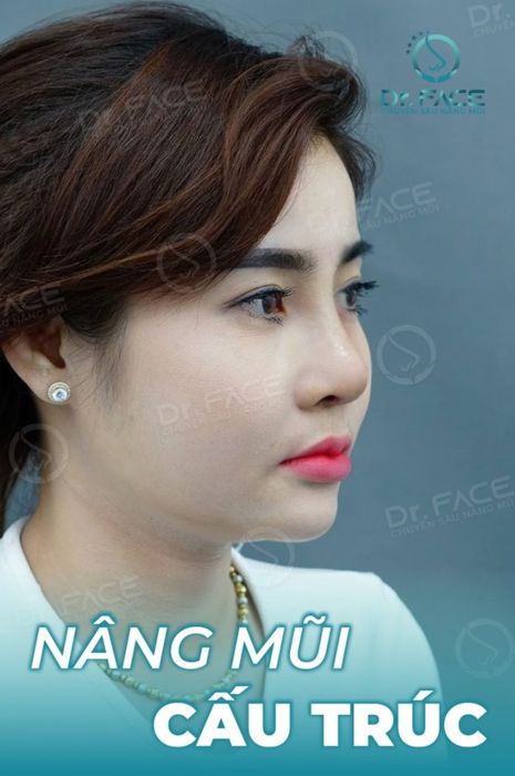 Viện Nâng Mũi Bác Sĩ Trần Phương hình ảnh 2