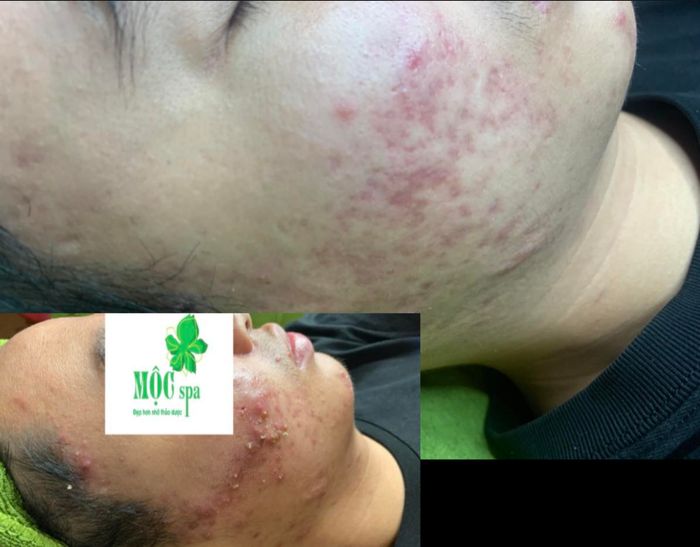 Mộc Spa hình ảnh 1