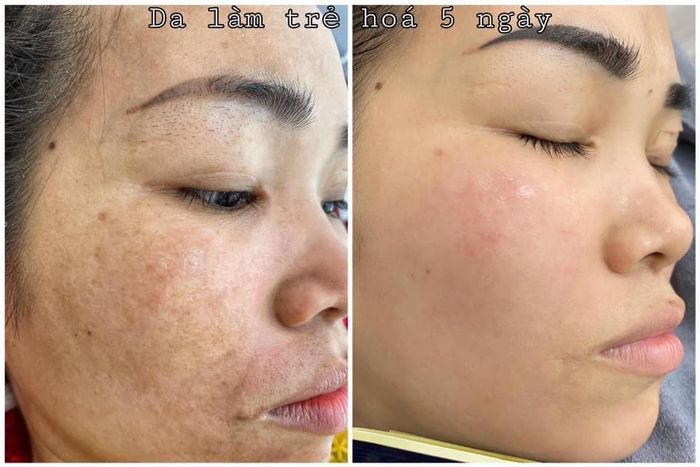 Huyền Spa hình ảnh 2
