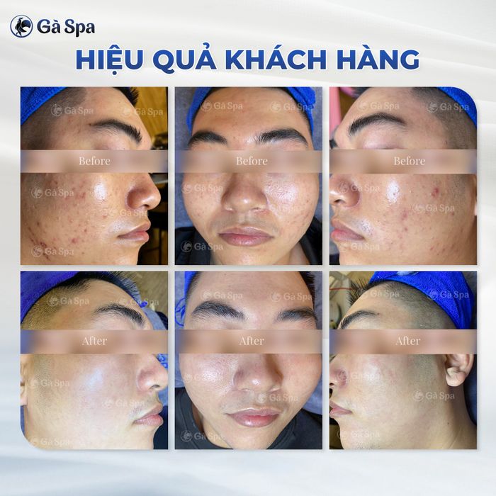 Gà Spa Quy Nhơn - Hình ảnh 1
