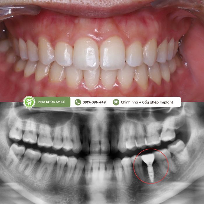 Nha Khoa Smile Tam Kỳ - Hình 1
