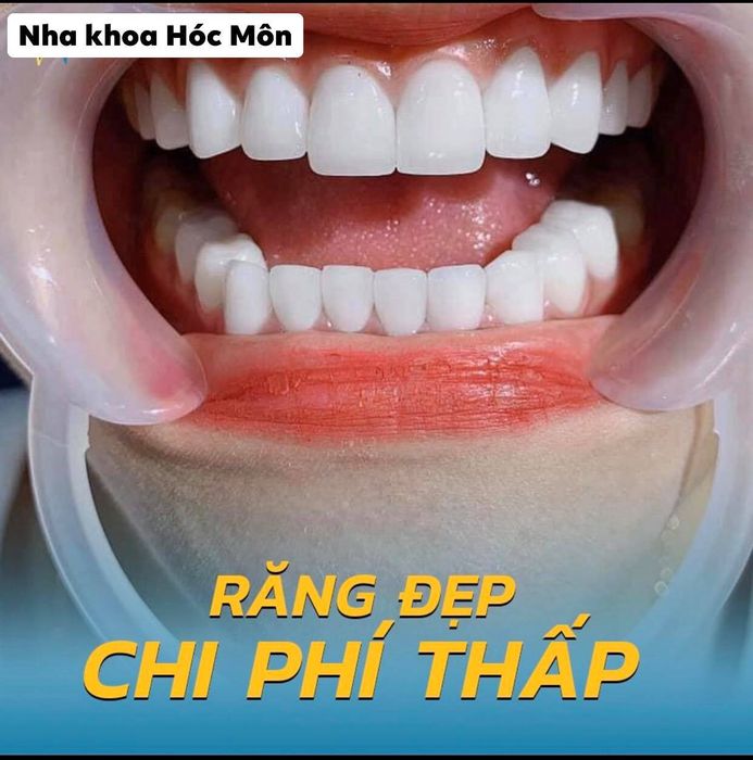 Nha Khoa Hóc Môn - Hình 1