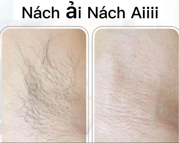 Hình ảnh 2 của Spa Mộc