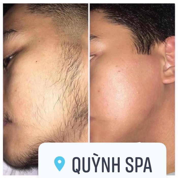 Quỳnh Spa - Hình ảnh 2