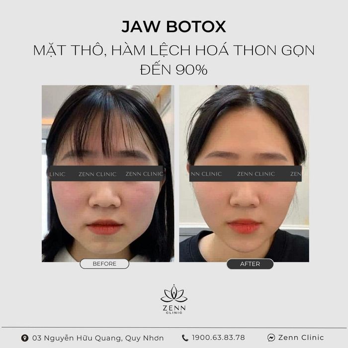 Ảnh ZENN Clinic 1