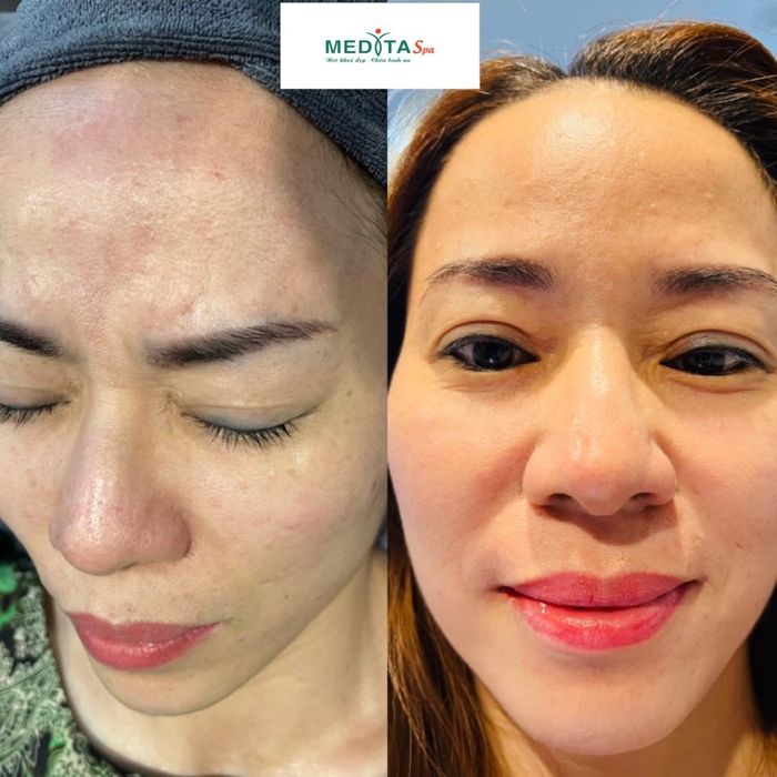 Hình ảnh 1 của Medita Spa Hà Đông