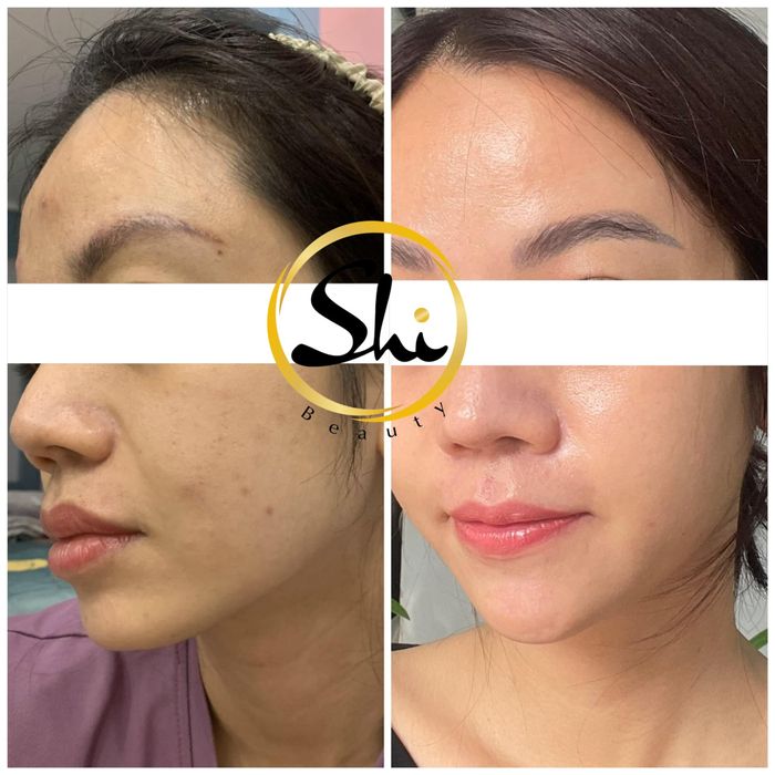 Hình ảnh SHI BEAUTY & SPA 1